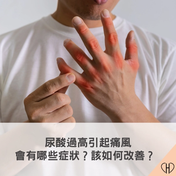 尿酸過高引起痛風