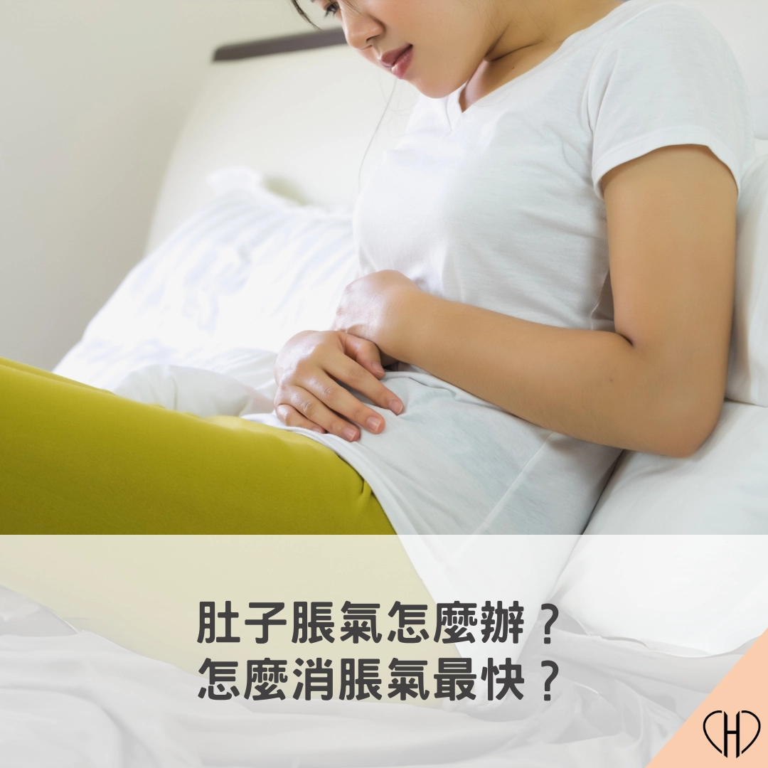 肚子脹氣怎麼辦?怎麼消脹氣最快?教你從原因找解法+飲食調整全攻略