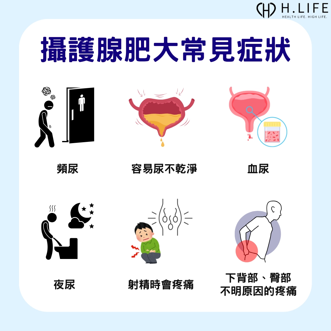 攝護腺肥大的常見症狀有哪些?
