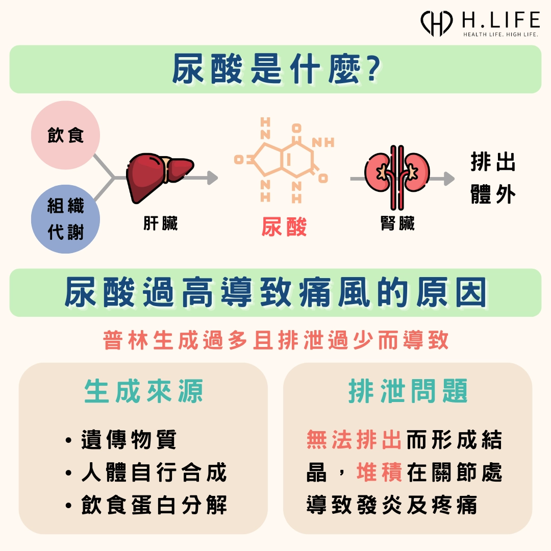 尿酸過高導致痛風的原因