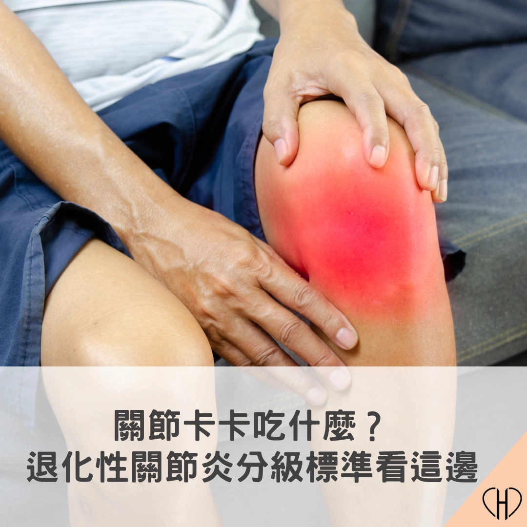 關節卡卡吃什麼？退化性關節炎分級標準看這邊